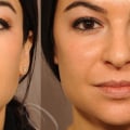 Where to Find the Best Dermal Fillers Near Me?