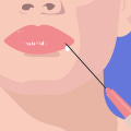 Everything You Need to Know About FDA-Approved Lip Fillers