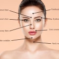 Dermal Fillers Explained