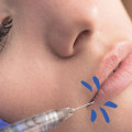 The History of Dermal Fillers: From the 19th Century to Today