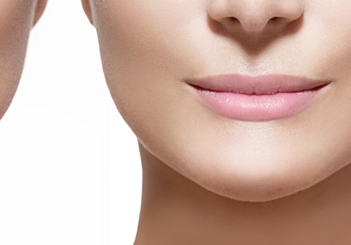 How Long Does it Take for Dermal Fillers to Settle?