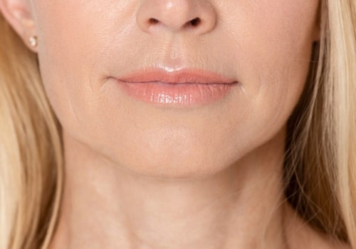 Can You Get Fillers for Jowls? A Comprehensive Guide