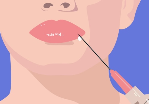 5 Danger Zones to Avoid When Injecting Dermal Fillers