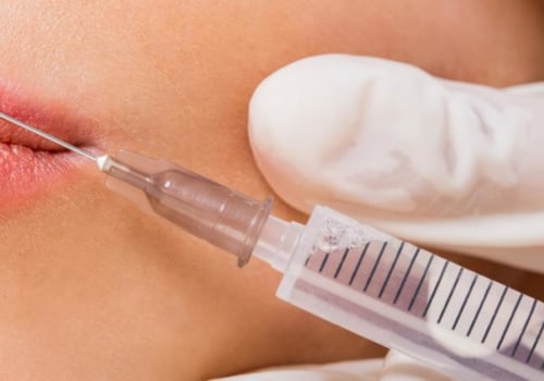 The Benefits of Dermal Fillers: How to Get the Most Out of Your Injections