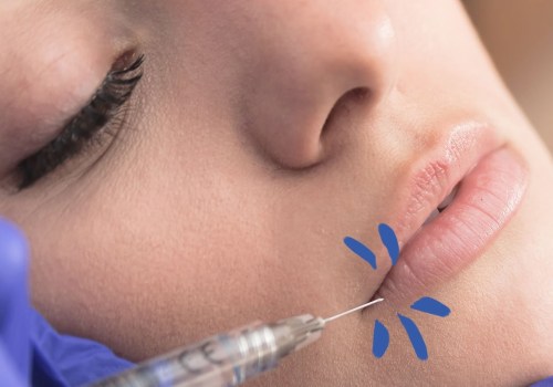 The History of Dermal Fillers: From the 19th Century to Today